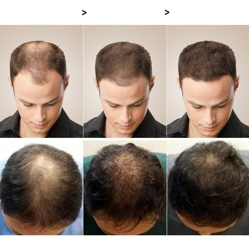 Óleo Mega Hair - Crescimento capilar 10x mais rápido