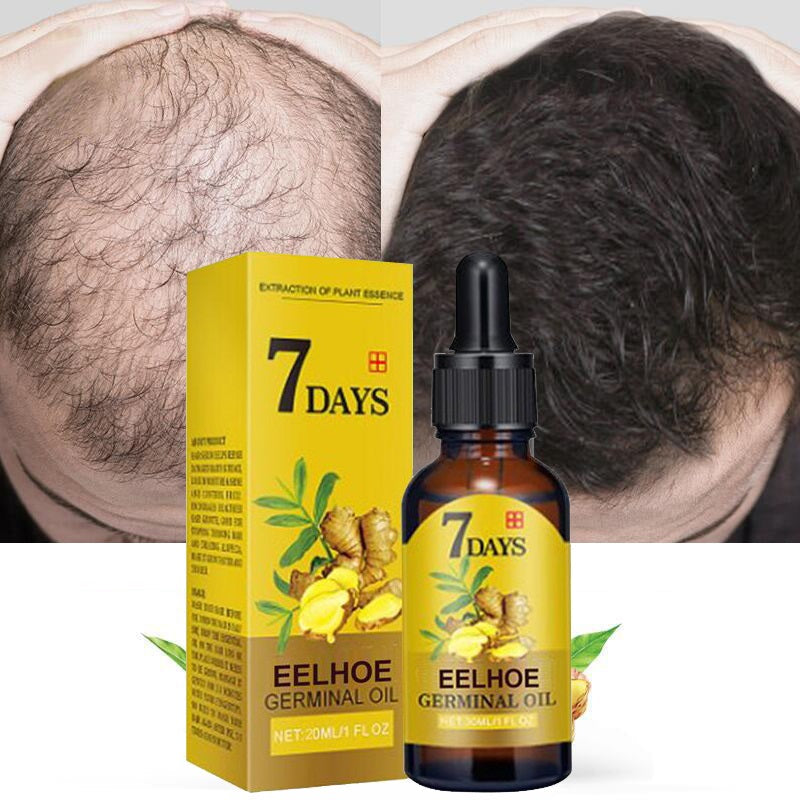 Óleo Mega Hair - Crescimento capilar 10x mais rápido